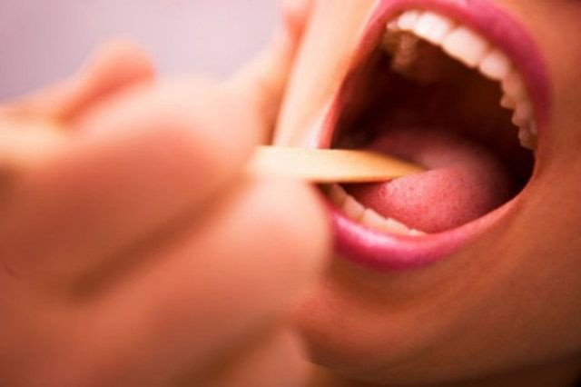Bên cạnh đau họng, viêm amidan còn làm tắc nghẽn cuống họng, khiến giọng nói của bạn thay đổi.