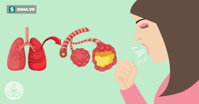 Trời lạnh rất dễ viêm phổi: 8 dấu hiệu tố cáo bệnh sớm biết để ngừa biến chứng nguy hiểm - Ảnh 1. Trời lạnh rất dễ viêm phổi: 8 dấu hiệu tố cáo bệnh sớm biết để ngừa biến chứng nguy hiểm - Ảnh 1.