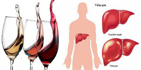 Lỡ uống nhiều rượu gây tổn thương gan, đây là cách giúp gan hồi phục hiệu quả - Ảnh 1.
