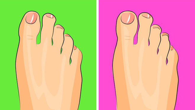 Nhìn ngay xuống bàn chân soi dấu hiệu bệnh tật cư trú trong người: Số 3 rất nguy hiểm! - Ảnh 8.