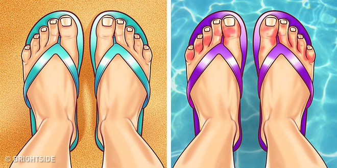 Nhìn ngay xuống bàn chân soi dấu hiệu bệnh tật cư trú trong người: Số 3 rất nguy hiểm! - Ảnh 9.