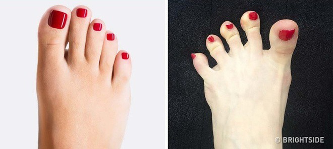Nhìn ngay xuống bàn chân soi dấu hiệu bệnh tật cư trú trong người: Số 3 rất nguy hiểm! - Ảnh 10.