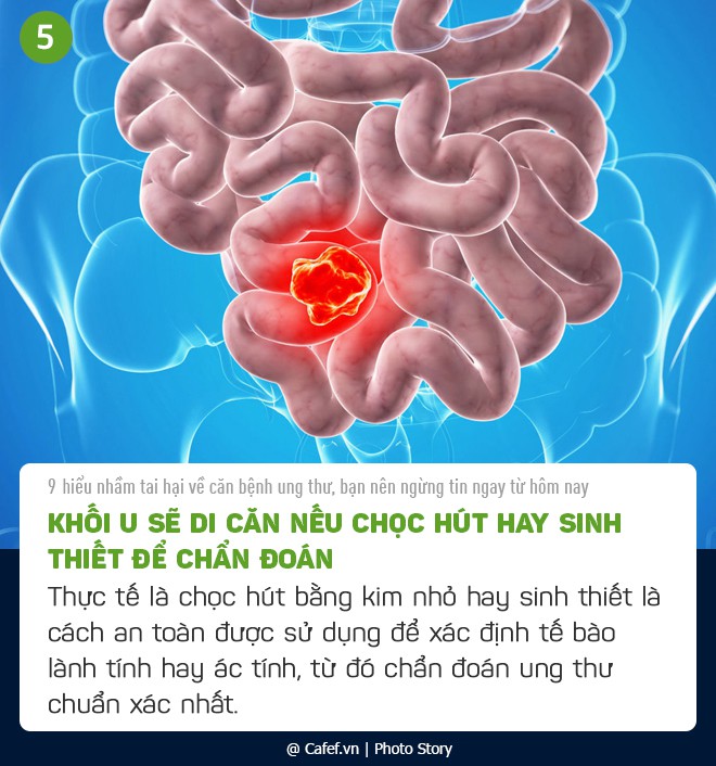 9 hiểu lầm tai hại về căn bệnh ung thư, bạn nên ngừng tin ngay từ hôm nay - Ảnh 5. 9 hiểu lầm tai hại về căn bệnh ung thư, bạn nên ngừng tin ngay từ hôm nay - Ảnh 5.