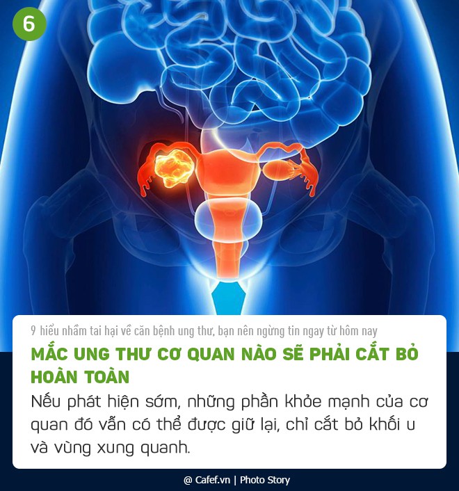 9 hiểu lầm tai hại về căn bệnh ung thư, bạn nên ngừng tin ngay từ hôm nay - Ảnh 6. 9 hiểu lầm tai hại về căn bệnh ung thư, bạn nên ngừng tin ngay từ hôm nay - Ảnh 6.