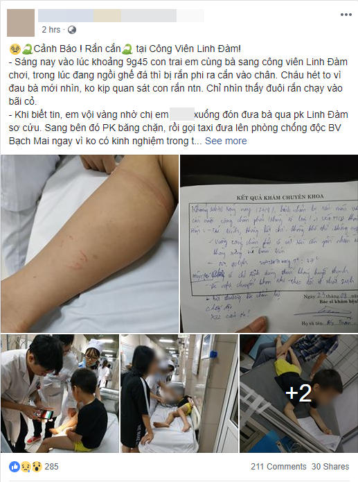 Hà Nội: Bé trai bị rắn cắn khi đang chơi cùng bà nội trong công viên ở Linh Đàm, phải nhập viện theo dõi - Ảnh 1.
