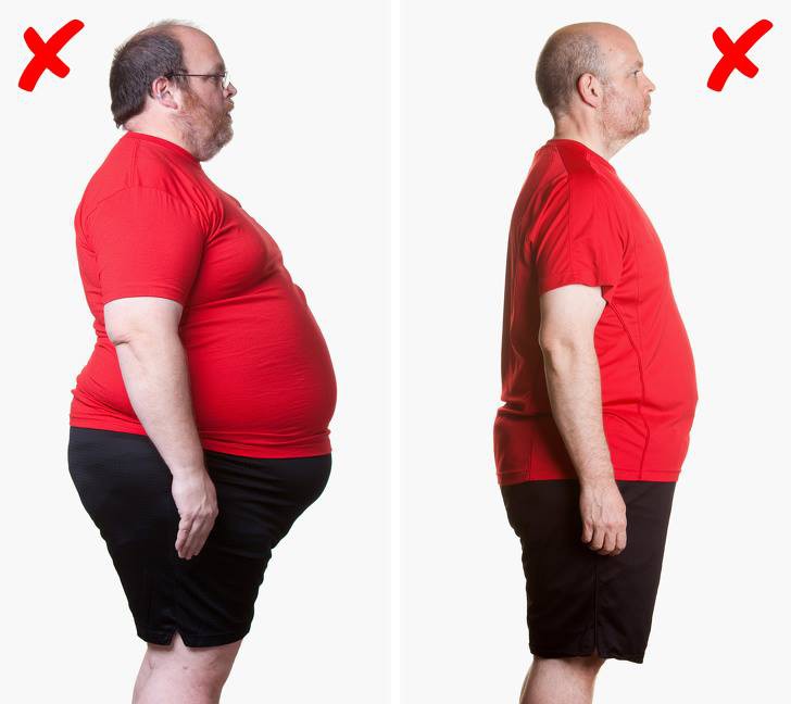 Căn bệnh nhà giàu gây đau đớn khủng khiếp: Đang gia tăng ở nam giới và đây chính là 4 điều nhất định phải biết - Ảnh 1. Căn bệnh nhà giàu gây đau đớn khủng khiếp: Đang gia tăng ở nam giới và đây chính là 4 điều nhất định phải biết - Ảnh 1.