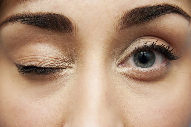 9 dấu hiệu bất thường trên đôi mắt cảnh báo bệnh tật nguy hiểm - Ảnh 5.