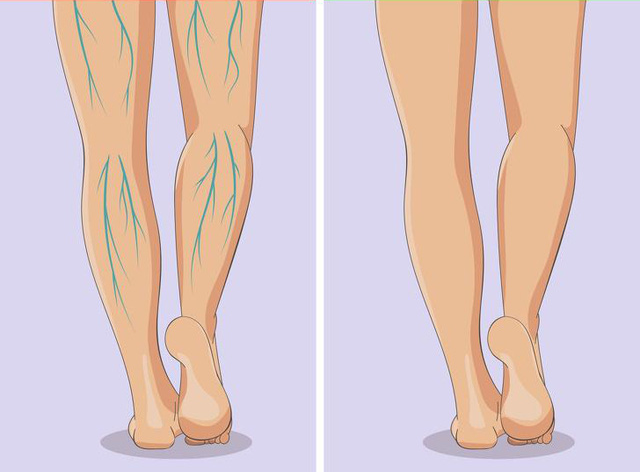 Xuất hiện 6 dấu hiệu này ở chân, bạn nên sớm đi gặp bác sĩ bởi sức khỏe đang gặp vấn đề nghiêm trọng - Ảnh 5.