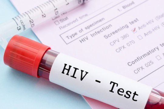 Lần đầu tiên các nhà khoa học loại bỏ được HIV trong toàn bộ gen của chuột: Đem lại hi vọng loại bỏ HIV ở người - Ảnh 2.