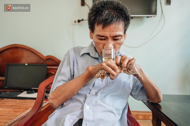 Số phận cay đắng của người cây kì lạ nhất Việt Nam: Mẹ cõng con đi điều trị gần 50 năm, phải uống thuốc ngủ để quên cơn đau - Ảnh 6.