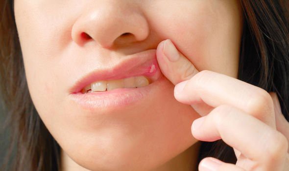 Loét miệng, vàng da và những tín hiệu cảnh báo cho thấy cơ thể đang thiếu hụt vitamin B12 - Ảnh 2.