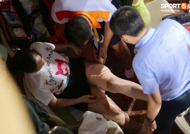 Vụ cổ động viên nữ trọng thương do trúng pháo sáng: Công an triệu tập 14 người quê ở Nam Định để điều tra - Ảnh 1.