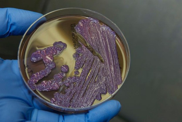 Mọi thông tin về căn bệnh nhiễm khuẩn ăn thịt người - Whitmore, đặc biệt là cách phòng ngừa cần lưu ý - Ảnh 5.