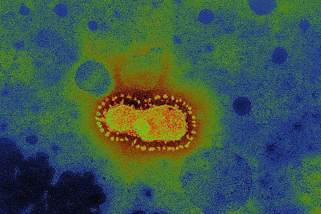 Virus corona từng được dự đoán sẽ giết 65 triệu người/năm trên thế giới chỉ 3 THÁNG trước khi thành dịch: Nguy hiểm hơn, nó có thể lây qua MẮT! - Ảnh 2.