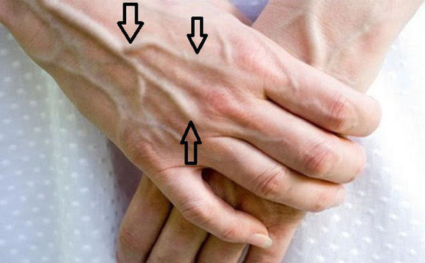 Người có chức năng gan ổn định sẽ không có 4 điểm sau trên đôi tay, cùng xem bạn có điểm nào hay không - Ảnh 3.