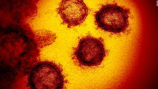 Chính xác thì virus corona Covid-19 tồn tại được bao lâu trên các bề mặt vật thể? Đây là câu trả lời từ khoa học - Ảnh 2.