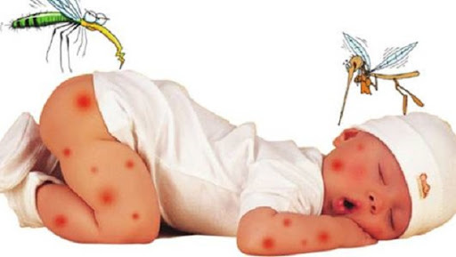 Bắt đầu vào mùa viêm não Nhật Bản, cha mẹ cần phân biệt triệu chứng sốt do viêm não Nhật Bản và bệnh lý khác để phòng bệnh cho con - Ảnh 1.