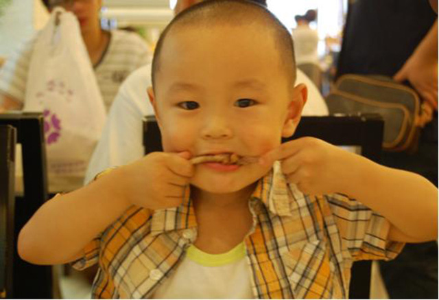 Bé trai 5 tuổi bị hoại tử ruột sau bữa ăn, bác sĩ cảnh báo 3 món ăn độc hại không nên cho trẻ ăn quá nhiều và thường xuyên - Ảnh 1.
