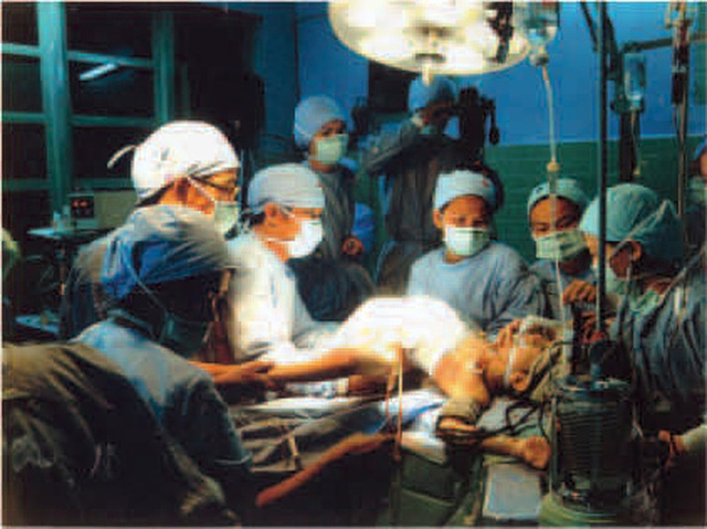 Nhìn lại ca phẫu thuật tách cặp song sinh Việt - Đức 32 năm trước: Ca mổ đi vào lịch sử y học Việt Nam - Ảnh 5.
