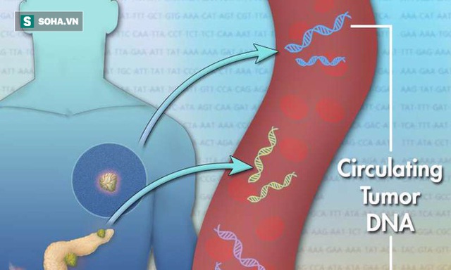 Các tế bào trong khối u khi chết sẽ giải phóng một lượng nhỏ ADN vào máu. Các đoạn ADN được gọi là ctDNA (cell-free circulating tumor DNA)