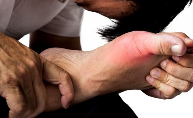 
Gout thường gây ra cơn đau ở các khớp.
