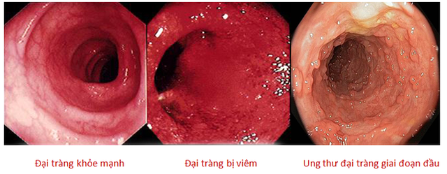 
(Ảnh minh họa)
