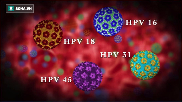 
Mỗi năm có khoảng 11.600 người tại Mỹ được chẩn đoán mắc phải ung thư khoang miệng do HPV gây nên.
