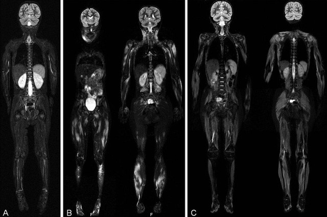 Ảnh chụp cộng hưởng từ toàn thân, những gì mà MRI có thể nhìn thấy bên trong cơ thể