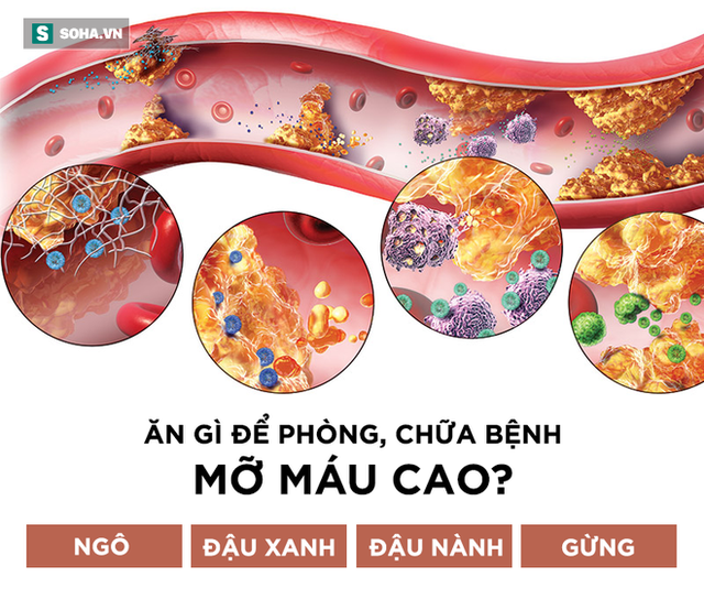  Không chỉ người béo, gầy cũng có thể bị mỡ máu cao: 6 thực phẩm nên ăn để tiêu mỡ nhanh - Ảnh 1.