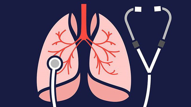 Dù bận mấy cũng nên làm 3 việc vô cùng có lợi cho phổi này vì nó góp phần ngăn ngừa ung thư phổi - Ảnh 5.