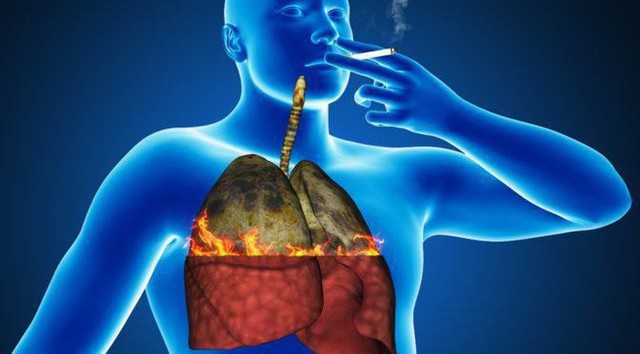  Chuyên gia vạch mặt thủ phạm gây 90% ca ung thư phổi ở VN: Nhiều người biết nhưng chưa sợ - Ảnh 2.