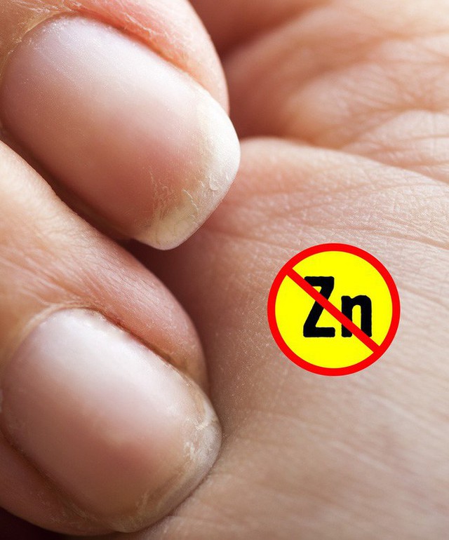 Dấu hiệu ở tay cũng có thể chỉ ra một số vấn đề về sức khỏe, đừng bao giờ bỏ qua dấu hiệu thứ 4 - Ảnh 7.