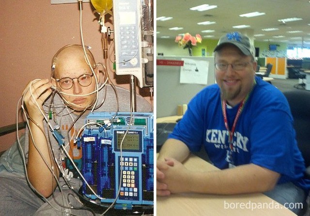  Ngắm 10 bức ảnh có thể truyền cảm hứng mạnh mẽ về bệnh nhân ung thư sau khi chữa khỏi - Ảnh 5.