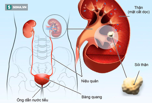 Người thận khỏe mới có thể sống thọ: 4 giải pháp chăm sóc thận không tốn kém lại hiệu quả - Ảnh 1.