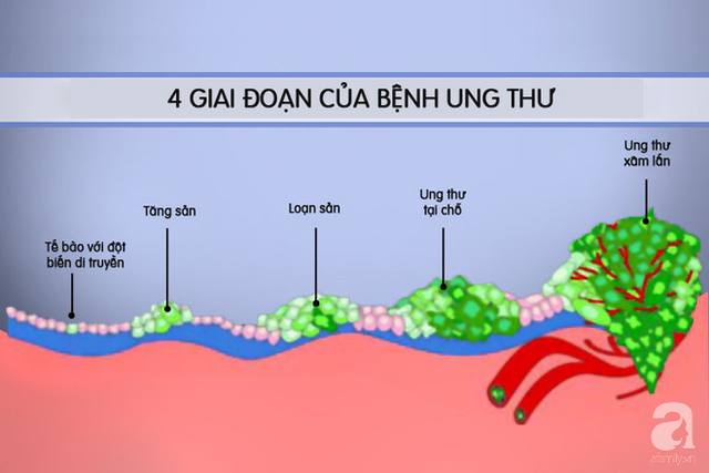 Clip cho thấy ung thư di căn phát triển như thế nào và phá hủy cơ thể người bệnh ra sao - Ảnh 1.