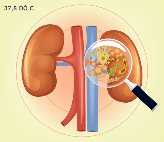 Tỉnh táo với 10 dấu hiệu không rõ ràng nhưng lại là tín hiệu cho thấy thận của bạn đang có vấn đề - Ảnh 5.