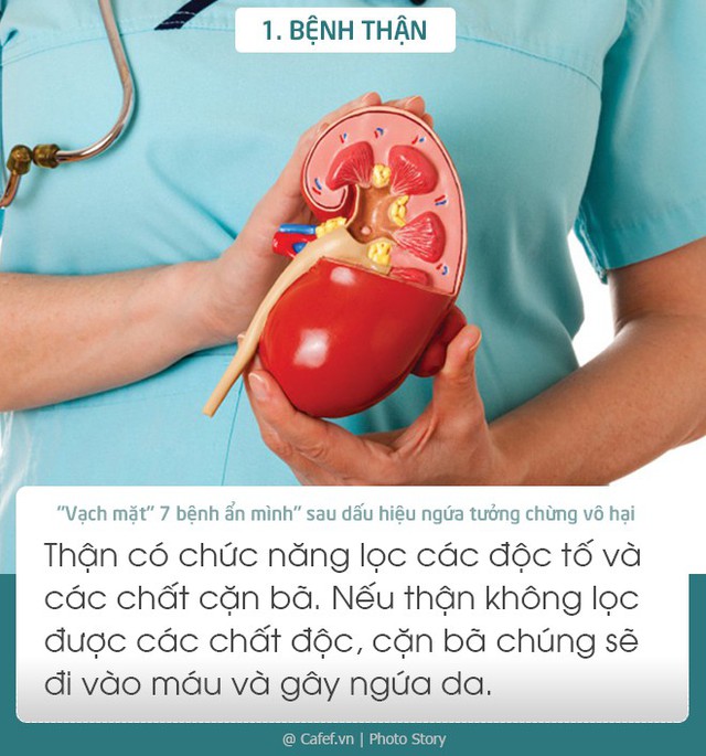 Vạch mặt 7 bệnh ẩn mình sau dấu hiệu ngứa tưởng chừng vô hại - Ảnh 1.