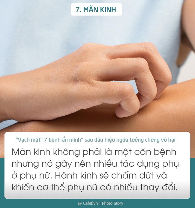 Vạch mặt 7 bệnh ẩn mình sau dấu hiệu ngứa tưởng chừng vô hại - Ảnh 7.