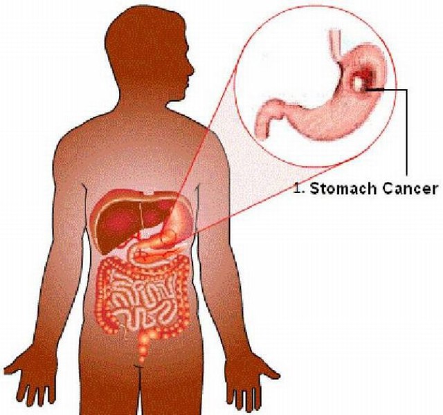 Sự thật thú vị về các nhóm máu bạn có thể không biết: Luôn bị muỗi đốt, dễ căng thẳng hay đãng trí cũng từ đây mà ra!  - Ảnh 1.