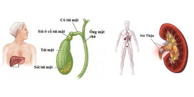  3 thói quen trong bữa tối đang nuôi lớn nhiều căn bệnh nguy hiểm: Hãy sớm tránh xa! - Ảnh 2.