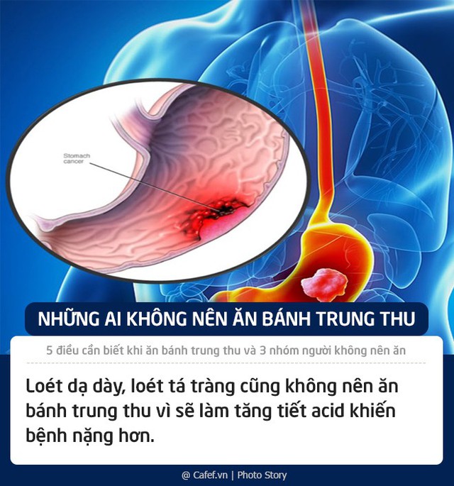 5 điều cần biết khi ăn bánh trung thu và 3 nhóm người không nên ăn - Ảnh 7.