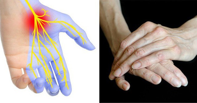 7 biểu hiện ở đôi tay tiết lộ các bệnh mà cơ thể đang mắc, dấu hiệu đầu tiên cảnh báo bạn đang bị bệnh gan đấy - Ảnh 3.