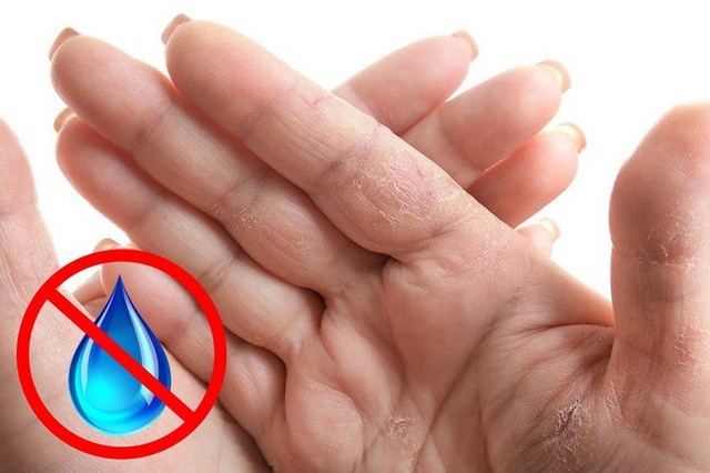 7 biểu hiện ở đôi tay tiết lộ các bệnh mà cơ thể đang mắc, dấu hiệu đầu tiên cảnh báo bạn đang bị bệnh gan đấy - Ảnh 4.