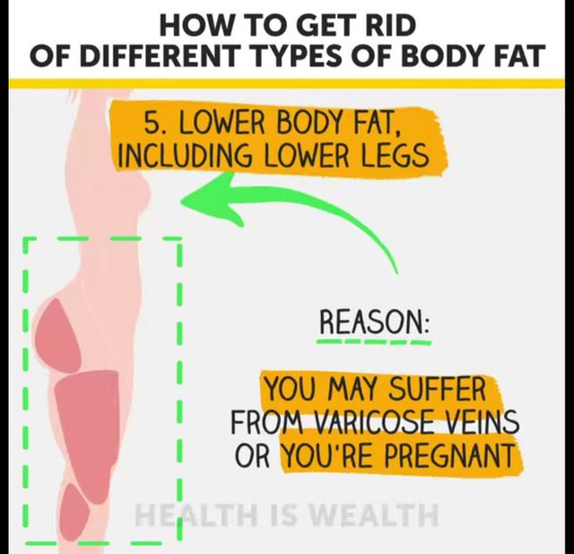  Béo bụng, to đùi, xệ mông và cách điều trị hiệu quả - Ảnh 13.
