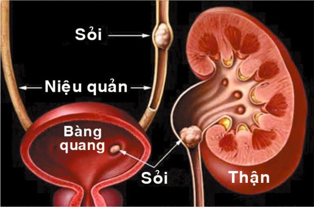 Mỗi người chỉ có hai quả thận, đừng vì thói quen xấu này mà mất nó - Ảnh 1.