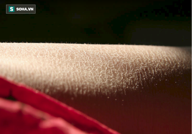 Tắm nước nóng có thể khiến da bị bốc hơi, dẫn đến khô da.