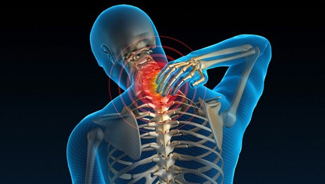 Bị đau lưng chớ nên coi thường: 5 căn bệnh này sẽ tàn phá bạn nếu không thăm khám kịp thời - Ảnh 4.