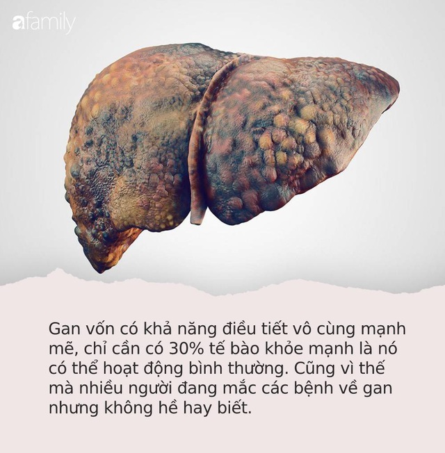 Hãy để ý: Nếu có dấu hiệu “3 đen 2 hôi” trên cơ thể thì có thể bạn đã mắc các bệnh về gan cần đi khám gấp - Ảnh 1.