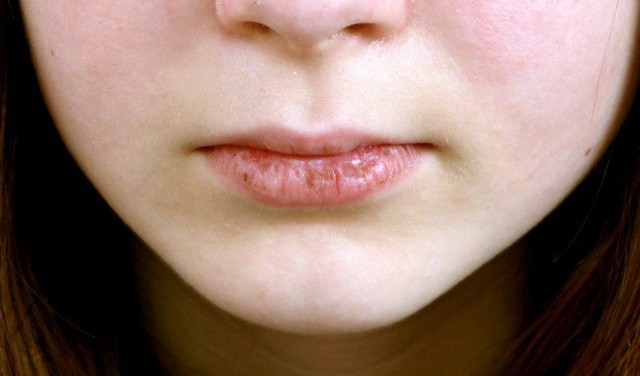 6 vấn đề sức khỏe ở vùng răng miệng mà không phải ai cũng biết, đặc biệt là cái số 3 - Ảnh 4.