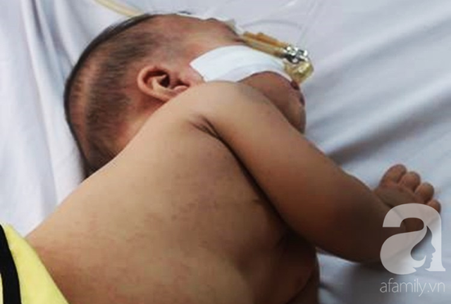 Dịch sởi đang diễn biến bất thường nhưng nhiều bà mẹ vẫn anti vaccine: Coi chừng mất mạng con - Ảnh 10.